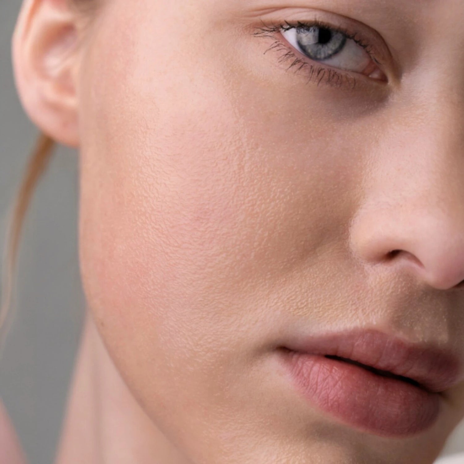 Gros plan d’un visage, texture de peau et zones de sécheresse, sujet peau sèche vs peau déshydratée.