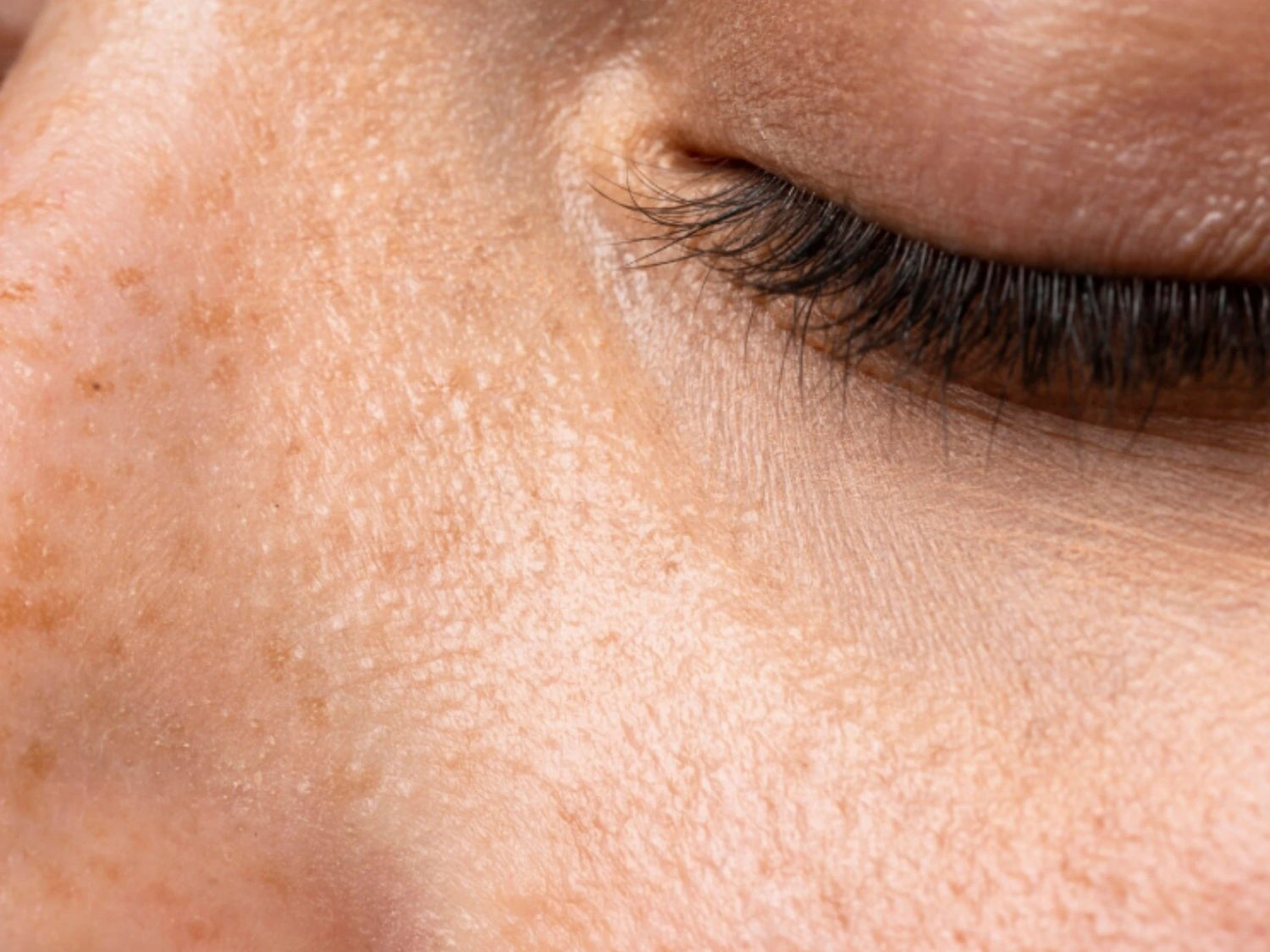 Gros plan du contour de l’œil, grain de peau et aspect plus uniforme, visuel associé au gel hydratant à la niacinamide Seomse.